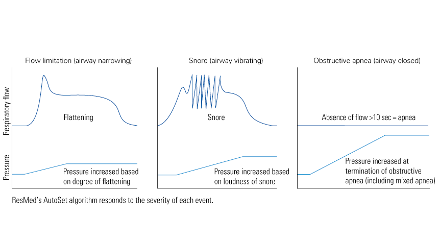 autoset-technology